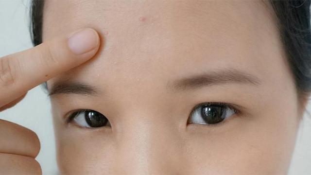 祛痘印的方法 - 这样祛痘印很简单 - 香港妮雨康肤堂 -护肤小常识